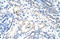c-Myc antibody, orb329967, Biorbyt, Immunohistochemistry paraffin image 