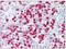 S100 Calcium Binding Protein A8 antibody, AM31838PU-N, Origene, Immunohistochemistry frozen image 