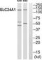 Solute Carrier Family 24 Member 1 antibody, TA314876, Origene, Western Blot image 