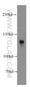 Adhesion G Protein-Coupled Receptor L3 antibody, 20045-1-AP, Proteintech Group, Western Blot image 