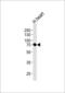Caseinolytic Mitochondrial Matrix Peptidase Chaperone Subunit antibody, GTX53477, GeneTex, Western Blot image 