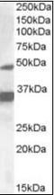 Nuclear Receptor Subfamily 1 Group I Member 2 antibody, orb89324, Biorbyt, Western Blot image 