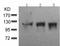 Protein Kinase D1 antibody, TA322965, Origene, Western Blot image 