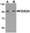 Forkhead Box O3 antibody, PA5-20973, Invitrogen Antibodies, Western Blot image 