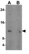 Trefoil Factor 3 antibody, GTX31422, GeneTex, Western Blot image 