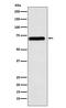 Nuclear RNA export factor 1 antibody, M02137-1, Boster Biological Technology, Western Blot image 