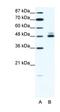 Cholinergic Receptor Nicotinic Beta 2 Subunit antibody, orb331573, Biorbyt, Western Blot image 