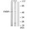 Fukutin Related Protein antibody, A02889, Boster Biological Technology, Western Blot image 