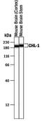 Cell Adhesion Molecule L1 Like antibody, PA5-47259, Invitrogen Antibodies, Western Blot image 