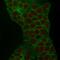 Tumor Associated Calcium Signal Transducer 2 antibody, AE00187, Aeonian Biotech, Immunocytochemistry image 
