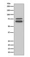 Fragile X Mental Retardation 1 antibody, M00192, Boster Biological Technology, Western Blot image 