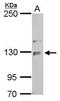 Nck-associated protein 1 antibody, GTX105682, GeneTex, Western Blot image 