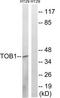 Protein Tob1 antibody, TA315020, Origene, Western Blot image 