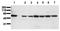 YES Proto-Oncogene 1, Src Family Tyrosine Kinase antibody, AM00159PU-N, Origene, Western Blot image 
