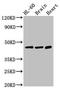 Carbohydrate sulfotransferase 1 antibody, LS-C677539, Lifespan Biosciences, Western Blot image 