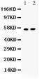 Islet Cell Autoantigen 1 antibody, PB9495, Boster Biological Technology, Western Blot image 