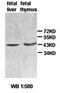 Actin Beta Like 2 antibody, orb77474, Biorbyt, Western Blot image 