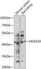 Hoxa-10 antibody, 23-652, ProSci, Western Blot image 