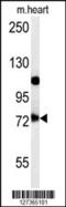 Ubiquitin carboxyl-terminal hydrolase 49 antibody, 62-112, ProSci, Western Blot image 