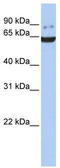 G Protein-Coupled Receptor Kinase 5 antibody, TA335088, Origene, Western Blot image 