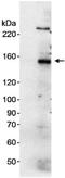 Fanconi anemia group I protein antibody, ab15344, Abcam, Western Blot image 