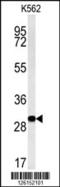 UPF0405 protein C3orf75 antibody, 61-814, ProSci, Western Blot image 