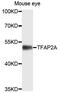 Transcription Factor AP-2 Alpha antibody, abx135702, Abbexa, Western Blot image 
