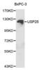 Ubiquitin Specific Peptidase 25 antibody, abx001257, Abbexa, Western Blot image 