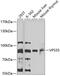 VPS35 Retromer Complex Component antibody, 22-714, ProSci, Western Blot image 