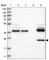 Zinc Finger AN1-Type Containing 6 antibody, HPA034845, Atlas Antibodies, Western Blot image 