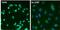 Estrogen Receptor 2 antibody, PA5-16440, Invitrogen Antibodies, Immunofluorescence image 