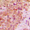 Ubiquitin Protein Ligase E3 Component N-Recognin 5 antibody, LS-C353442, Lifespan Biosciences, Immunohistochemistry frozen image 