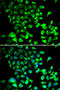 Single-stranded DNA-binding protein, mitochondrial antibody, 22-609, ProSci, Immunofluorescence image 