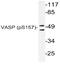 Vasodilator Stimulated Phosphoprotein antibody, AP20814PU-N, Origene, Western Blot image 