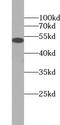 TRNA Methyltransferase 61B antibody, FNab09009, FineTest, Western Blot image 