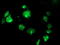 Signal Sequence Receptor Subunit 1 antibody, TA503144, Origene, Immunofluorescence image 