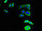 Discoidin Domain Receptor Tyrosine Kinase 2 antibody, orb51614, Biorbyt, Immunofluorescence image 