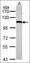 Aminopeptidase Puromycin Sensitive antibody, orb69790, Biorbyt, Western Blot image 