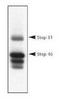 Protein Tyrosine Phosphatase Non-Receptor Type 5 antibody, TA309823, Origene, Western Blot image 