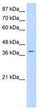 Lysine Acetyltransferase 6B antibody, TA343698, Origene, Western Blot image 