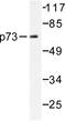 Tumor Protein P73 antibody, AP06273PU-N, Origene, Western Blot image 