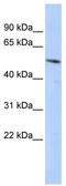 BCL6B Transcription Repressor antibody, TA345618, Origene, Western Blot image 
