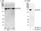 ATP-dependent RNA helicase A antibody, A300-854A, Bethyl Labs, Western Blot image 