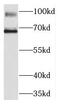 Kirre Like Nephrin Family Adhesion Molecule 2 antibody, FNab04590, FineTest, Western Blot image 
