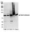 DNA Cross-Link Repair 1C antibody, A304-902A, Bethyl Labs, Western Blot image 
