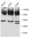 Hyaluronate receptor antibody, FNab10424, FineTest, Western Blot image 