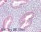 Myotubularin 1 antibody, 45-910, ProSci, Immunofluorescence image 