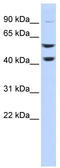 ATPase H+ Transporting V1 Subunit B2 antibody, TA337651, Origene, Western Blot image 