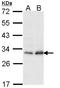 Phosphomannomutase 2 antibody, LS-C109535, Lifespan Biosciences, Western Blot image 