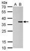 Collagen Type XI Alpha 2 Chain antibody, MA5-27738, Invitrogen Antibodies, Western Blot image 